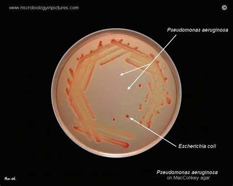 pseudomonas on macconkey agar|Pseudomonas Aeruginosa Gram Stain, Culture .